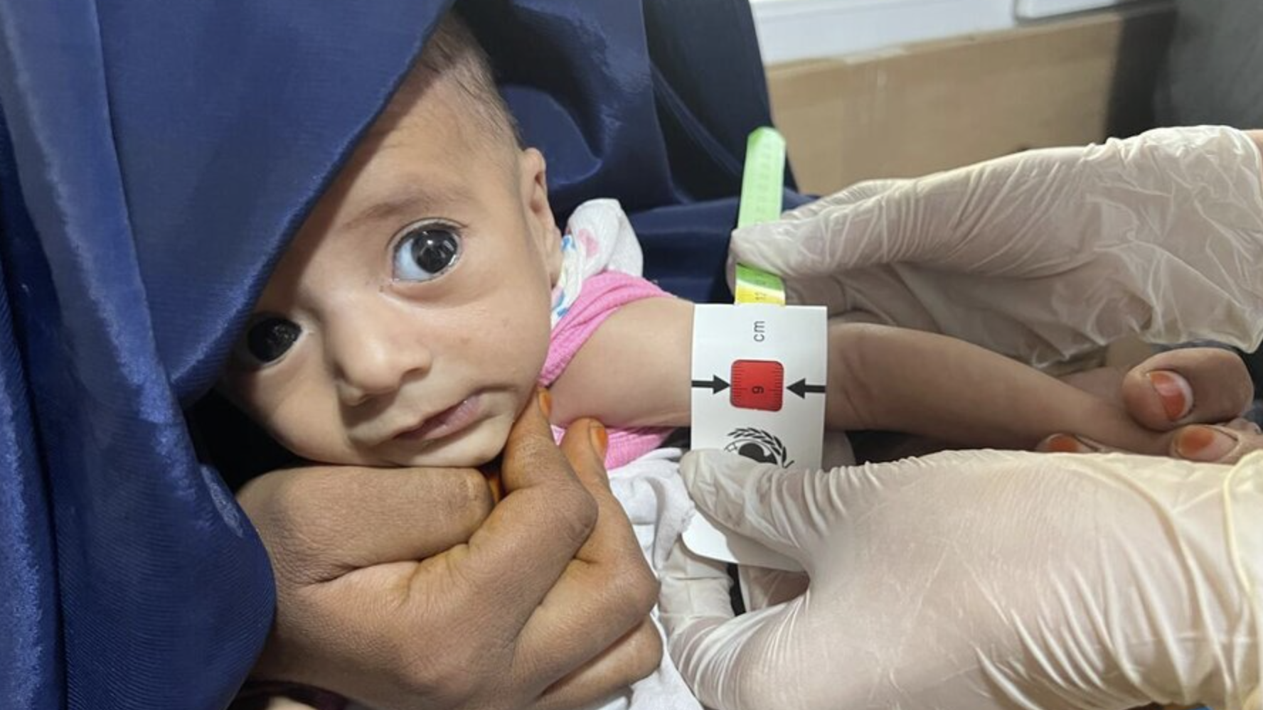 Close-up of baby in mother's arms as health care worker, wearing gloves, measures arm circumference.
